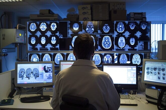 Image d'illustration. Imagerie du cerveau.